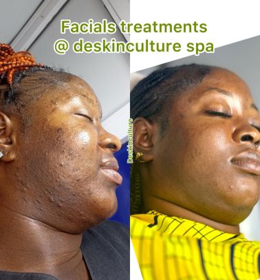 De Skinculture | Top Rated Spa In Awka - Beauty and Skincare in Awka
