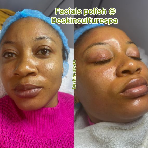 De Skinculture | Top Rated Spa In Awka – Beauty and Skincare in Awka, Anambra (Gallery image 2)